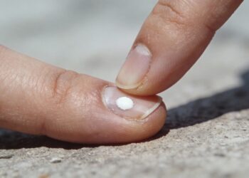 Roer a unha e manicure agressiva causam microtraumas que viram manchas brancas