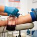 Esse procedimento parecido com doação de sangue trata acúmulo de ferro e previne danos aos órgãos