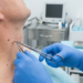 Verrugas do pescoço têm tratamento simples, mas exigem avaliação médica