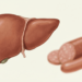Quais são os efeitos do consumo de linguiça, presunto, chouriço e outras carnes processadas em pessoas com doença hepática gordurosa?