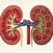 Doença renal pode evoluir de forma silenciosa, comprometendo a função dos rins antes que sintomas evidentes apareçam.
