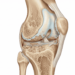 Quais são as alternativas para tratar a osteoartrite do joelho e reduzir a dor?
