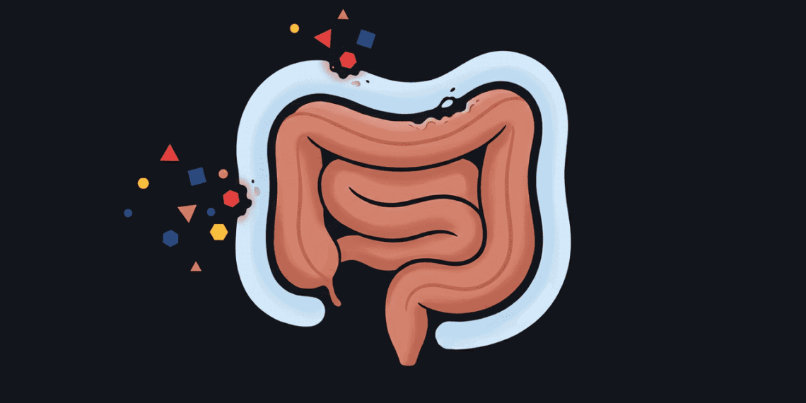 Ingredientes ultraprocessados que inflamam o intestino sem você perceber