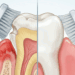 Como escovar os dentes corretamente e por que a pressão da escova faz tanta diferença