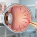 Glaucoma pode causar cegueira irreversível e muitas pessoas não sabem que têm a doença