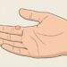 Por que surgem verrugas na pele: como preveni-las e tratá-las?