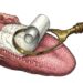 Como eliminar o mau hálito que não passa mesmo escovando os dentes?