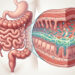 Barriga estufada após o almoço? O alimento que ajuda o intestino