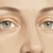 Os sintomas de colesterol alto manifestam-se nos olhos