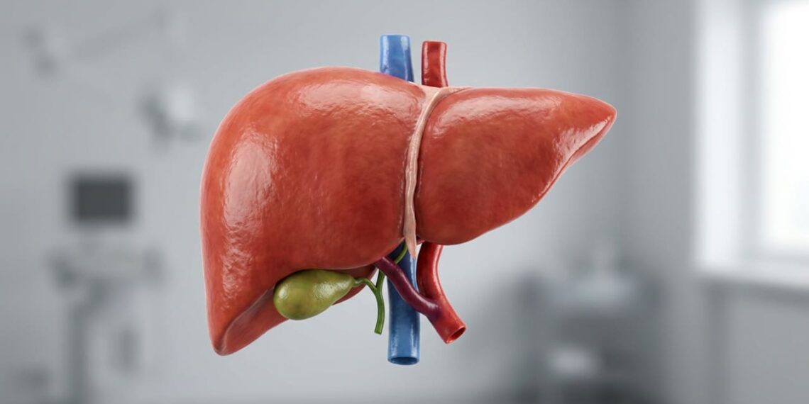 Fígado gorduroso: O que comer para reduzir a inflamação e eliminar a gordura acumulada?