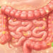 Como fortalecer o intestino naturalmente: os truques mais eficazes