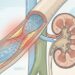 Um médico especialista em cardiologia evita a todo custo o consumo excessivo de cálcio isolado para proteger as artérias