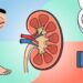 Como saber se seus rins estão filtrando bem: 4 sinais que aparecem antes de qualquer exame de sangue acusar