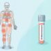 Deficiência de vitamina D e dor nos ossos: como saber se você está abaixo do nível ideal e o que fazer