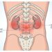 Dor na parte baixa das costas: que sinais de doença renal ou coluna podem indicar?