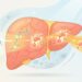 A falta de vitamina D não se deve à falta de sol, mas sim a problemas digestivos como inflamação intestinal ou irritação do fígado