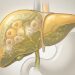 Uma raiz anti-inflamatória que ajuda a proteger o fígado e equilibrar as enzimas hepáticas