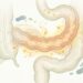 Como usar a cúrcuma pura para tratar o supercrescimento bacteriano e desinflamar o intestino?
