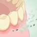 Como o óleo de melaleuca atua para tratar a inflamação crônica na gengiva e diminuir o risco de perda óssea?