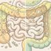 Quais são os sintomas da síndrome do intestino permeável e como diferenciá-la de intolerância alimentar