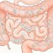 O inchaço abdominal não é causado apenas pela alimentação: 4 fatores que muitas pessoas ignoram