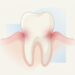 Como tratar a dor de dente em casa e diminuir o risco de uma infeção grave