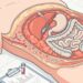 Uma das maneiras de identificar resistência à insulina é através da maneira como o corpo distribui gordura abdominal
