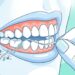 O fio dental remove biofilme bacteriano em regiões que a escova não alcança e previne doenças sistêmicas