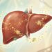 Qual a quantidade de magnésio recomendada para combater a esteatose hepática?