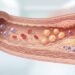 A inflamação crônica de baixo grau está ganhando relevância na saúde cardiovascular e no desenvolvimento de doenças autoimunes