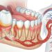Dentes e coração: Por que você deve escovar os dentes antes de dormir?