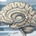 Alzheimer: qual é a primeira coisa que uma pessoa começa a esquecer