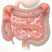 SIBO: o que é, os sintomas mais comuns e como tratar o supercrescimento bacteriano intestinal