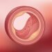 A inflamação silenciosa desempenha um papel decisivo no desenvolvimento do câncer e de doenças cardiovasculares