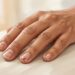Quais nutrientes estão em falta quando as unhas quebram com facilidade e crescem devagar?