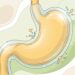 Alimentos que participam da proteção da mucosa do estômago