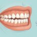 Ranger os dentes durante o sono não é apenas estresse, pode estar ligado a parasitas intestinais ou deficiência mineral