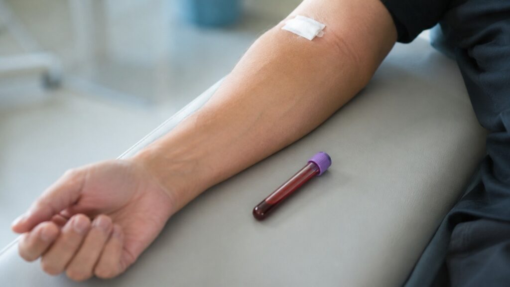 O exame de sangue continua sendo essencial para confirmar alterações no colesterol e nos triglicerídeos.