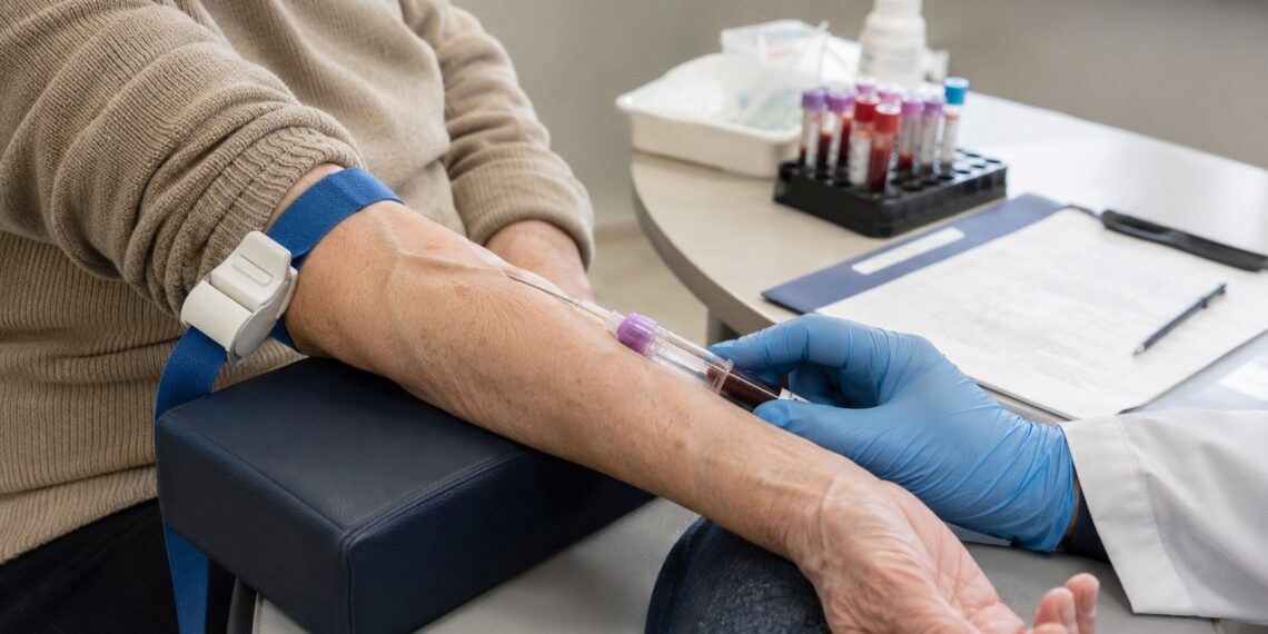 O exame de sangue pode apoiar a investigação quando há sinais reais de declínio cognitivo.
