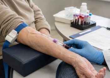 O exame de sangue pode apoiar a investigação quando há sinais reais de declínio cognitivo.