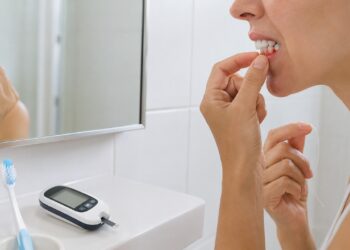 O sangramento frequente na gengiva pode ser um alerta para inflamação bucal ligada ao diabetes.