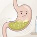 Bicarbonato antes do treino: quando pode ajudar no desempenho e quando vira risco gastrointestinal