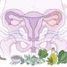 Como aliviar os sintomas incômodos da endometriose, como cólicas intensas, dor pélvica ou cansaço extremo
