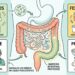 Probióticos: o que são, para que servem e quais alimentos os contêm para equilibrar o intestino