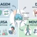 Além do alívio da dor: cientistas descobrem proteína que pode deter a osteoartrite