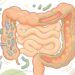 Cinco mudanças simples na dieta que podem transformar a saúde intestinal