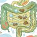 Intestino preso: O que comer para regular o trânsito intestinal e melhorar a digestão?