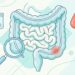 O sintoma intestinal que adultos jovens mais demoram a levar a sério