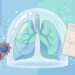A vacina que voltou ao radar aos 50 anos para prevenir pneumonia grave