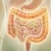 Como saber se tenho intestino permeável, sintomas digestivos e extra-intestinais que costumam ser ignorados